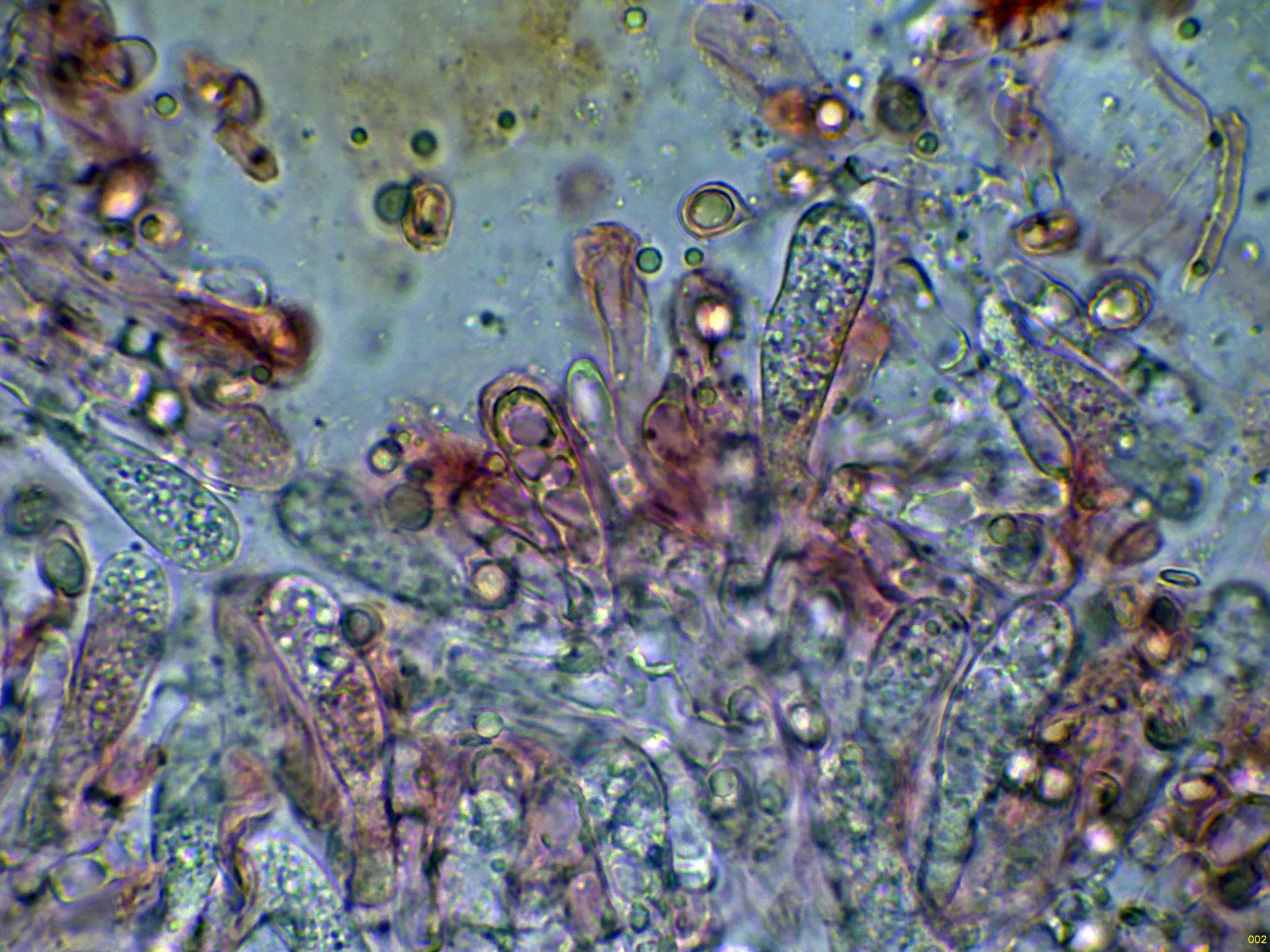 Microscopía de Pseudoclitopilus rhodoleucus - 10 - Arista laminar-002